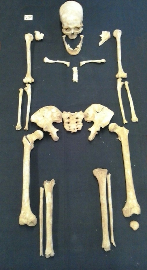 Zu sehen ist ein sehr gut erhaltenes Skelett  auf schwarzem Grund zu sehen. Man erkennt deutlich den Schädel samt Unterkiefer, das Brustbein, die Schlüsselbeine, die Arme, die Beine und das Becken. Im linken oberen Rand des Bildes liegt ein kleiner Zettel, auf dem sich die Grabnummer 9 befindet.